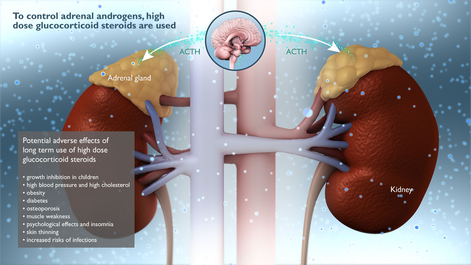 Excessive Glucocorticoid Steroids and Reduced Adrenal Androgens diagram